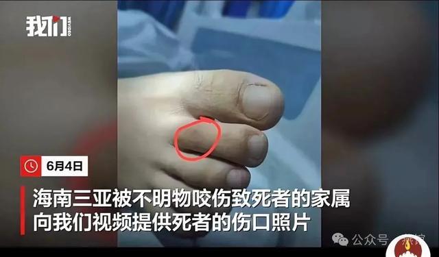 三亚毒蛇咬人事件那些忽视的真相！(图2)